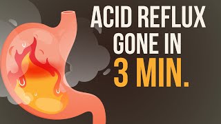 Reduce your Acid Reflux  Heartburn in just 3 Minutes 🔥 [upl. by Annuahsal]