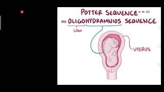 NEONATAL ANAMOLY PATHOLOGY CLASS ONLINE SESSION [upl. by Ayocat]