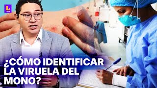 La nueva variante de la viruela del mono ¿Qué se sabe sobre la Mpox [upl. by Droffig]