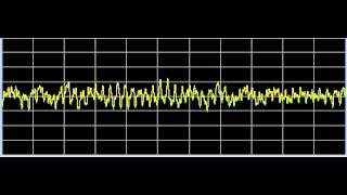 Coughing General  Rife Frequencies [upl. by Zoara]