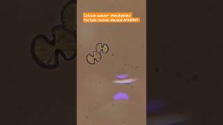 Calcium oxalate Monohydrate ✨️ laboratory laboratoryFacebookviralvideo [upl. by Oos]