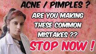 Skincare Mistakes that Cause Acne  Acne prone Skin care  Acne treatment at home  Acne Removal [upl. by Olleina]