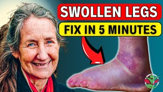 7 REMEDIES to Make SWOLLEN LEGS amp FEET Go Away in Minutes  Barbara O’Neills Secret [upl. by Itagaki]