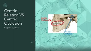 Centric Relation VS Centric Occlusion [upl. by Giacamo]