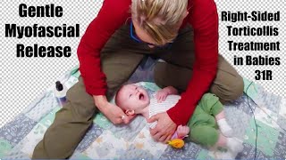 31R Gentle Myofascial Release RightSided Torticollis Treatment in Babies [upl. by Elsbeth]