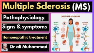 Multiple sclerosis pathophysiology signs amp symptoms Homeopathic treatment Dr ali muhammad [upl. by Silvana]