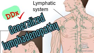 Approach to Diagnosing Generalized Lymphadenopathy [upl. by Gebhardt]