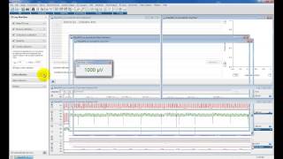 Analysing Pressurevolume PV loops using ADInstruments LabChart Pro [upl. by Teeniv398]