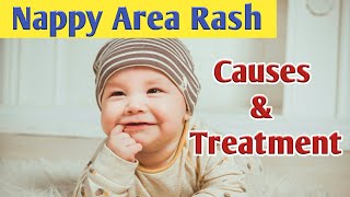 Nappy Area Rash Causes Symptoms Diagnosis amp Treatment [upl. by Maurita]