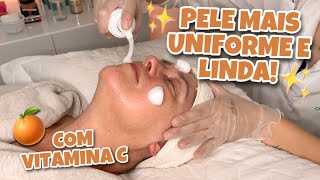 TRATAMENTO FACIAL COM VITAMINA C  LIFE C TULÍPIA [upl. by Chrissy]