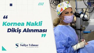 Kornea Nakli Dikiş Alınması  Prof Dr Safiye Yılmaz [upl. by Alison]