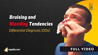 Bruising and Bleeding Tendencies  Differential Diagnosis DDx  Medicine Education [upl. by Cathyleen748]