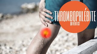 Comment traiter les thrombophlébites et caillots des veines par radiologie interventionnelle [upl. by Mayhs]