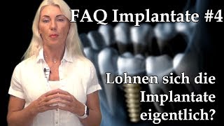 Implantat 4 Lohnen sich die Implantate eigentlich  Was kostet ein Implantat Backenzahn [upl. by Letsirc]