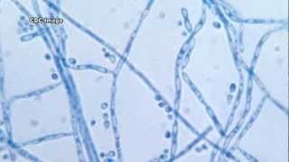 Cladosporium and IAQ [upl. by Burl]