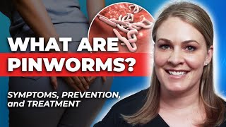 How To Treat Pinworms Symptoms Transmission Treatment amp Prevention [upl. by Cathryn757]