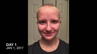 2017 Timelapse 365 Days of Hair Growth [upl. by Nahallac]