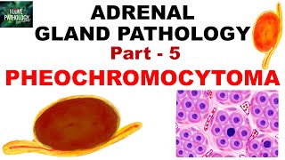 Adrenal Gland Pathology Part 5 PHEOCHROMOCYTOMA  Genetics  clinical features  Pathology [upl. by Onitsuj229]