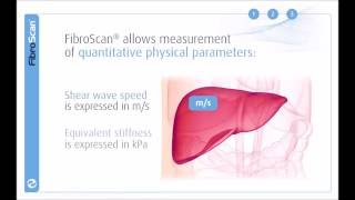 3 Stages of the FibroScan examination [upl. by Yrogerg]