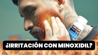 ELIMINA la IRRITACIÓN O RESEQUEDAD FACIAL Rápido 🔥 Secretos para BARBA y MINOXIDIL [upl. by Oswald]