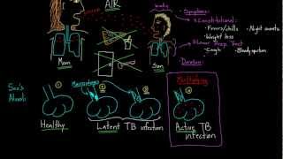 Symptoms and Spread of Tuberculosis [upl. by Ajiam258]