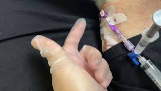 How to delcot a PICC CVC central line catheter with thrombolytic enzymes Alteplase cathflo turorial [upl. by Wolenik]