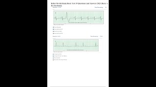 Relias Dysrhythmia Basic Test Answers 2023 update [upl. by Novaat]