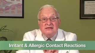 Irritant amp Allergic Contact Reactions [upl. by Armalda16]