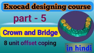 Exocad Video Tutorial Introduction to Basic Features Offset Coping Design  Offset Coping in exocad [upl. by Reta]