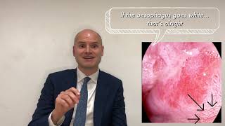 Endoscopy Top Tips UGI  Assessing Barretts and Increasing Dysplasia Detection [upl. by Haldes663]