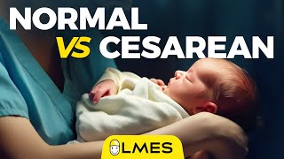 Normal Delivery vs Csection  LMES  Tamil [upl. by Krissie]