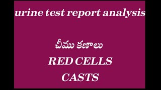 urine test report analysis in telugu [upl. by Odelet]