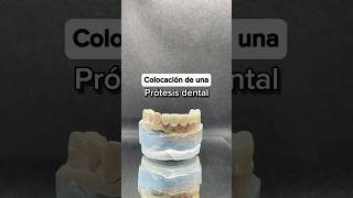 La prótesis dental no solo completa tu sonrisa también mejora tu calidad de vida 🦷✨shorts [upl. by Otokam]