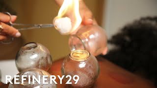 I Tried Cupping Therapy  Macro Beauty  Refinery29 [upl. by Ainelec]