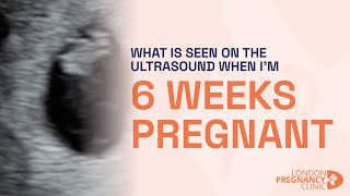 6 Weeks Pregnant Witnessing the First Heartbeat on ultrasound scan [upl. by Eniagrom25]