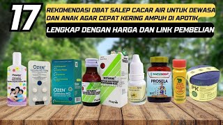 17 Rekomendasi Merek Obat Salep Cacar Air Untuk Dewasa dan Anak Agar Cepat Kering Ampuh Di Apotik [upl. by Eemiaj]