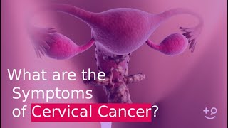 What are the Symptoms of Cervical Cancer [upl. by Lachman]