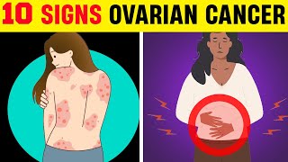 10 Ovarian Cancer Signs 90 of Women Ignore [upl. by Adiari54]