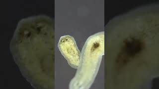 Planarian parasite flatworms under microscope [upl. by Enymsaj63]