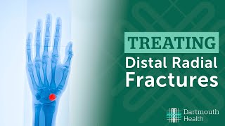 Treating Distal Radius Fractures at Dartmouth Health [upl. by Leasia]