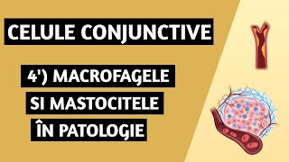 Țesutul conjunctiv  Celule conjunctive  macrofage și mastocite în patologie [upl. by Flagler]