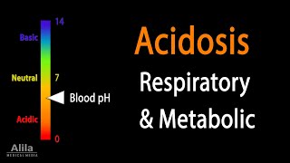 Acidosis Respiratory and Metabolic Animation [upl. by Anse]