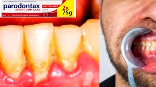 Parodontax Toothpaste  GSK  Plaque  Bad Breath  Gums Problem  Sodium Bicarbonate [upl. by Boj]