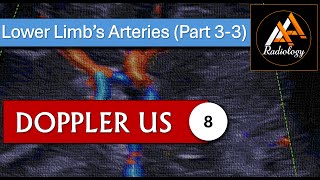 8  Lower Limbs Arteries Part 33 [upl. by Akihsal]