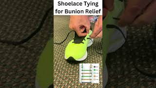 Shoelace Tying for Bunion Relief [upl. by Wahs812]