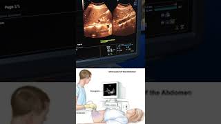 Abdomen ultrasound baby abdomen reels [upl. by Eecrad]