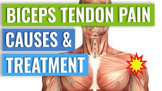 Biceps Tendonitis Treatment and Exercises Explained [upl. by Case]