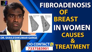 Fibroadenoma of Breast in Women Causes amp New Treatment in Telugu  Citi Vascular Centre [upl. by Kath]