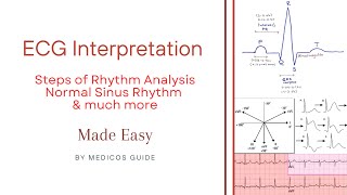 ECG Interpretation  Part 3  Steps of Rhythm Analysis Normal Sinus Rhythm and much more  ecg [upl. by Tilagram]