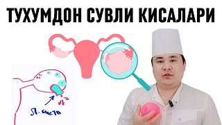 Функционал киста Фолликуляр ва Лютеин кисталари сабалари Асорати ва Даво чоралари хақида Исчанов [upl. by Adnam734]